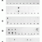 <strong>Figure 6  Slot Blot Validation of Survivin in Hepatocellular Carcinoma (HCC) Patients (Zhang et al., 2007) </strong><br>Slot blot analysis of Survivin recombinant protein expression with anti-Survivin antibodies (2235) in the four representative HCC sera.  Survivin (Lane 7) was detected in the fourth HCC serum (E), but not in the normal human serum (A) and the other three HCC sera (B-D).  Phosphate bufferedsaline (PBS) (Lanes 9 and 10) was used as a negative control..