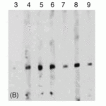 <strong>Figure 8 Western Blot Validation of Survivin with Recombinant Protein in Sera from Cancer Patients (Megliorino et al., 2005)</strong><br>WB analysis of Survivin recombinant protein expression with anti-Survivin antibodies (2235) in six cancer sera.  6 x His-tagged Survivin recombinant protein (Lanes 4-9) was strongly detected at 28kD, but not in the normal human serum (Lane 3).