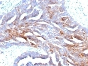 TAG-72 Antibody [B72.3]