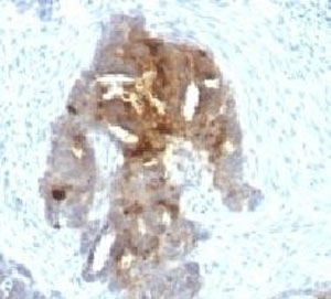 TAG-72 Antibody [TAGP-4]