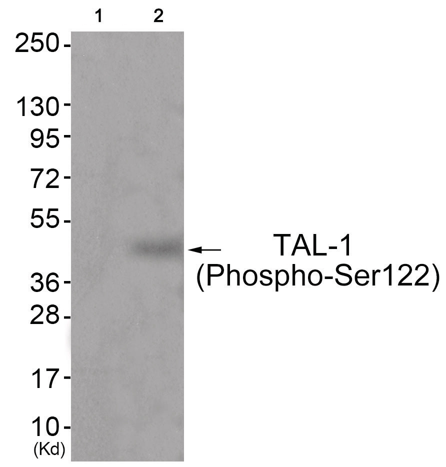 TAL-1 (phospho Ser122) Antibody