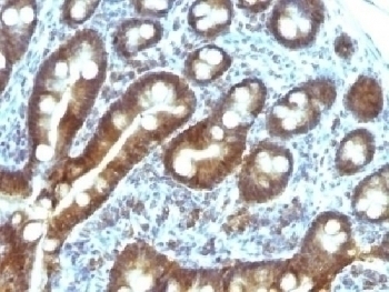 TDP2 Antibody [TDP2/1258]