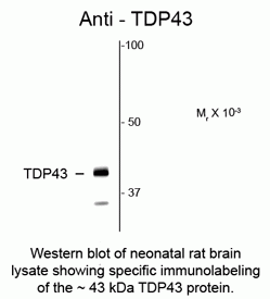 TDP43 Antibody