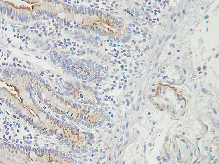 TECK Antibody [1.2_4G1-1G4-1C9]