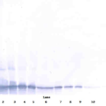 To detect hTECK by Western Blot analysis this antibody can be used at a concentration of 0.1-0.2 ug/ml. Used in conjunction with compatible secondary reagents the detection limit for recombinant hTECK is 1.5-3.0 ng/lane, under either reducing or non-reducing conditions.