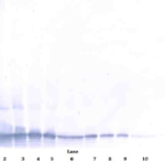 To detect hTECK by Western Blot analysis this antibody can be used at a concentration of 0.1 - 0.2 ug/ml. Used in conjunction with compatible secondary reagents the detection limit for recombinant hTECK is 1.5 - 3.0 ng/lane, under either reducing or non-reducing conditions.