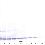 To detect hTECK by Western Blot analysis this antibody can be used at a concentration of 0.1 - 0.2 ug/ml. Used in conjunction with compatible secondary reagents the detection limit for recombinant hTECK is 1.5 - 3.0 ng/lane, under either reducing or non-reducing conditions.