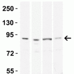 <strong>Figure 3 Western Blot Validation in Human Tissue</strong><br>Loading: 15 μg of lysates per lane.Antibodies: TEM-1 4359, (0.5 μg/mL), 1h incubation at RT in 5% NFDM/TBST.Secondary: Goat anti-rabbit IgG HRP conjugate at 1:10000 dilution.