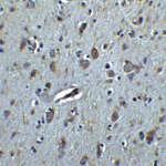 Immunohistochemistry of TET3 in human brain tissue with TET3 antibody at 2.5 μg/ml.