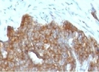 TFF1 Antibody [BCEIP1]