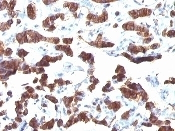 Thyroglobulin Antibody [TGB24]