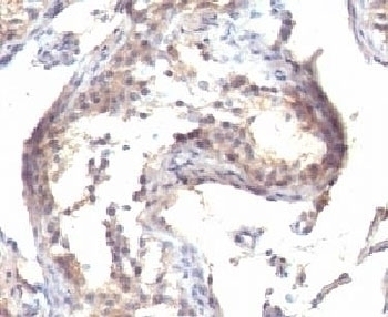 TGF alpha Antibody [MF9]