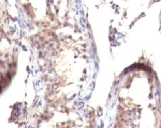 TGF alpha Antibody [TFGFa-1]