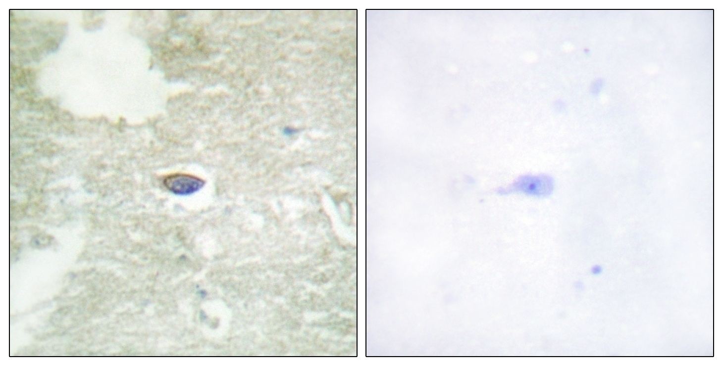 TGF beta Receptor II (phospho Ser225/250) Antibody