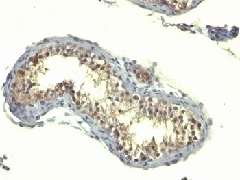 TGFa Antibody [TG86]