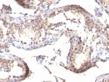 TGFa Antibody [TGFA/1119]