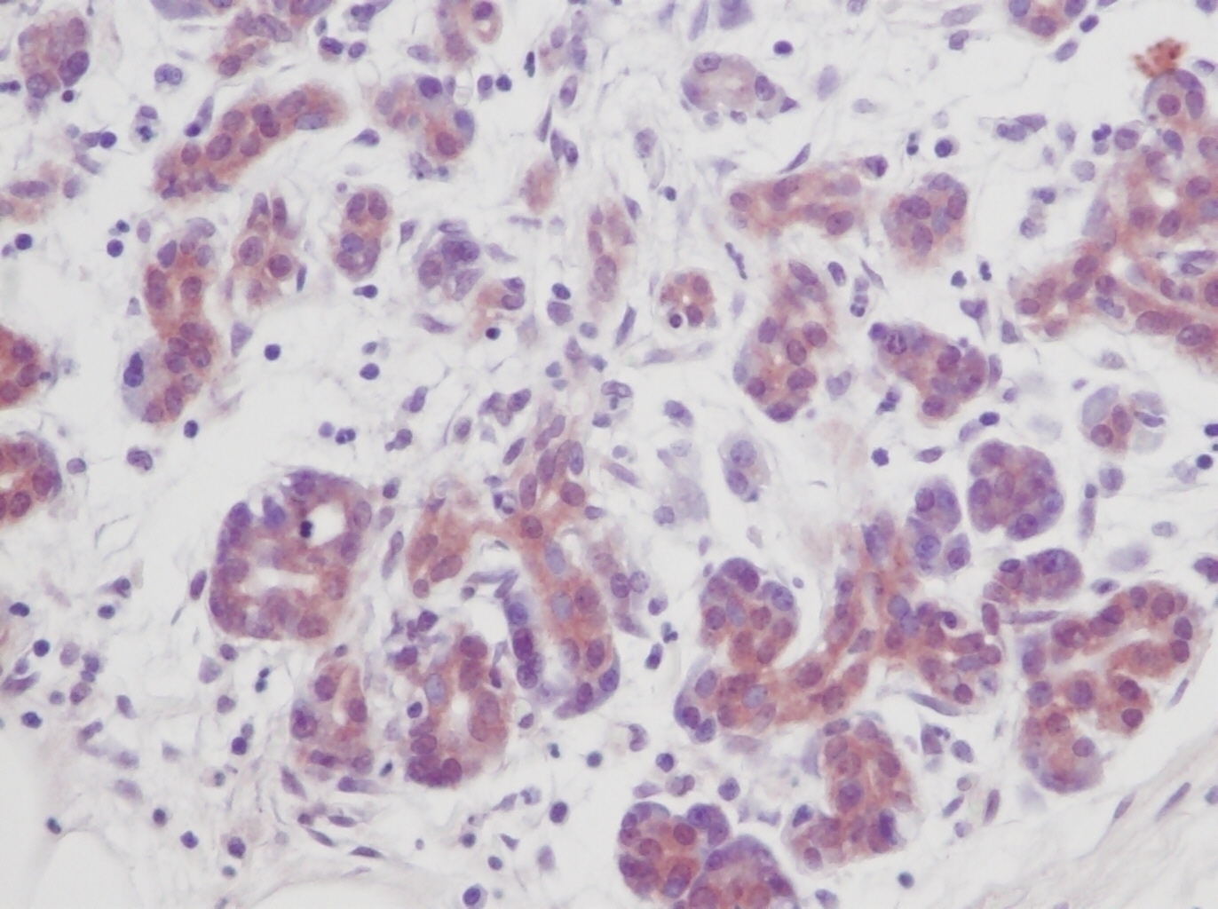 TGFb1 Antibody [M66-4B]