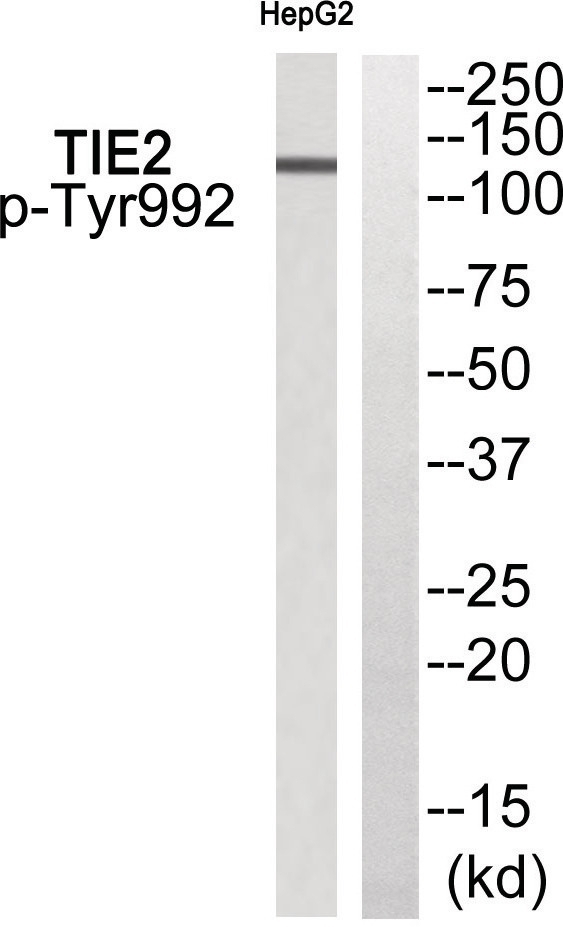 TIE2 (phospho Tyr992) Antibody