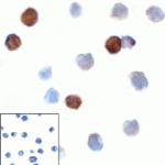 Immunocytochemistry of TIGIT in over expressing HEK293 cells using TIGIT antibody and control mouse IgG antibody (left corner box) at 1 μg/ml.