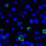 Immunofluorescence of TIGIT in over expressing HEK293 cells using TIGIT Antibody at 1 μg/ml.<br><br>Green: TIGIT Antibody [10B1] (RF16058) <br> Blue: DAPI staining