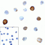 Immunocytochemistry of TIGIT in over expressing HEK293 cells using TIGIT antibody and control mouse IgG antibody (left corner box) at 1 μg/ml.
