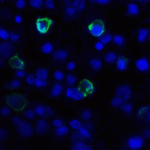 Immunofluorescence of TIGIT in over expressing HEK293 cells using TIGIT Antibody at 1 μg/ml.<br><br>Green: TIGIT Antibody [3B5] (RF16053) <br> Blue: DAPI staining
