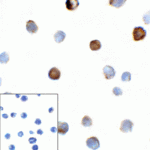 Immunocytochemistry of TIGIT in over expressing HEK293 cells using TIGIT antibody and control mouse IgG antibody (left corner box) at 1 μg/ml.