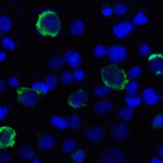 Immunofluorescence of TIGIT in over expressing HEK293 cells using TIGIT Antibody at 1 μg/ml.<br><br>Green: TIGIT Antibody [4A10] (RF16054) <br> Blue: DAPI staining