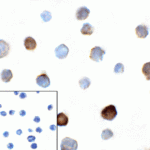 Immunocytochemistry of TIGIT in over expressing HEK293 cells using TIGIT antibody and control mouse IgG antibody (left corner box) at 1 μg/ml.