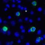 Immunofluorescence of TIGIT in over expressing HEK293 cells using TIGIT Antibody at 1 μg/ml.<br><br>Green: TIGIT Antibody [4A12] (RF16056) <br> Blue: DAPI staining