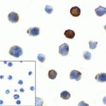 Immunocytochemistry of TIGIT in over expressing HEK293 cells using TIGIT antibody and control mouse IgG antibody (left corner box) at 1 μg/ml.