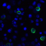 Immunofluorescence of TIGIT in over expressing HEK293 cells using TIGIT Antibody at 1 μg/ml.<br><br>Green: TIGIT Antibody [7E5] (RF16051) <br> Blue: DAPI staining
