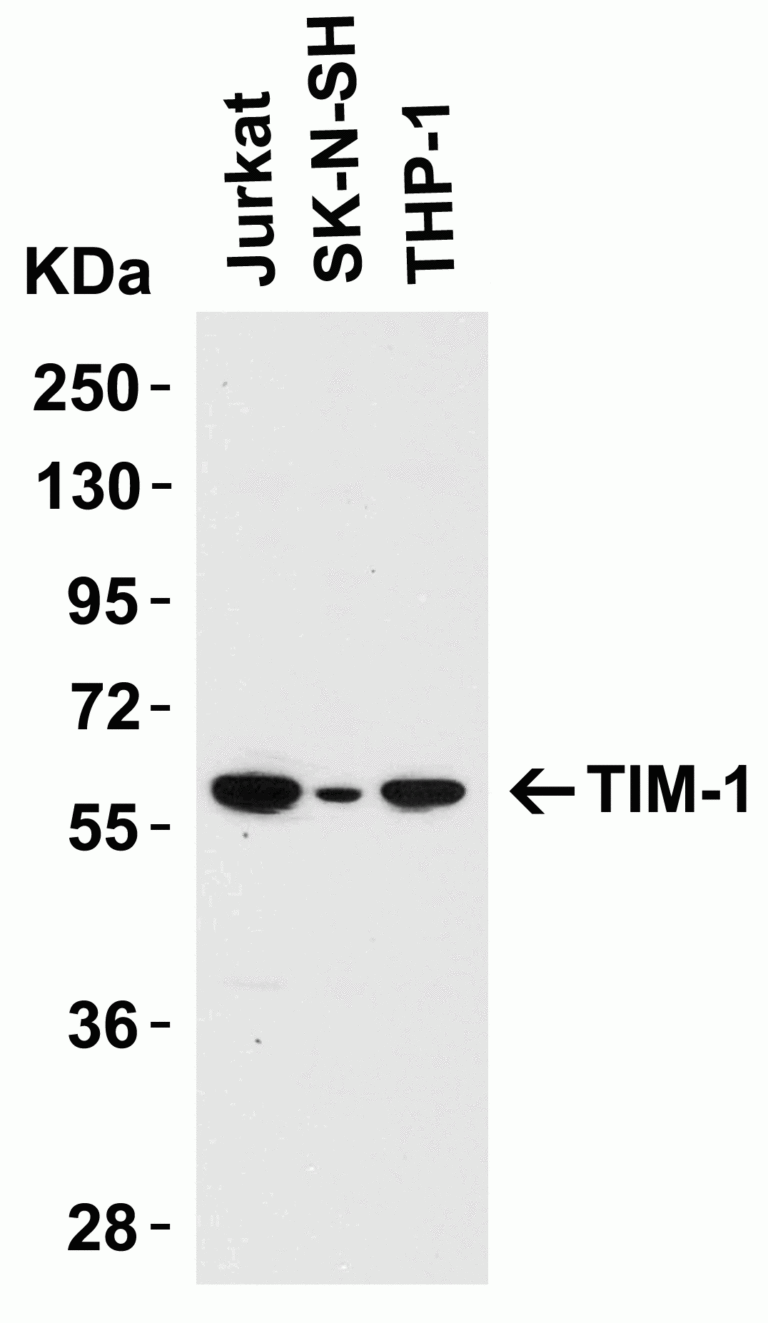 TIM-1 Antibody