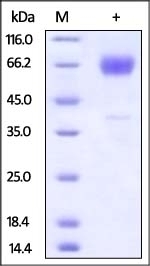 TIM-3 Recombinant Protein
