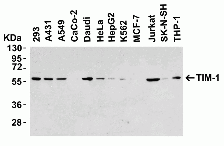 TIM-1 Antibody