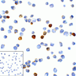 Immunocytochemistry of TIM-3 in transfected HEK293 cells with TIM-3 antibody at 1 μg/mL. Lower left: Immunocytochemistry in transfected HEK293 cells with control mouse IgG antibody at 1 μg/mL.