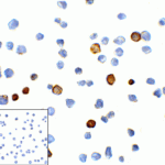 Immunocytochemistry of TIM-3 in transfected HEK293 cells with TIM-3 antibody at 1 μg/mL. Lower left: Immunocytochemistry in transfected HEK293 cells with control mouse IgG antibody at 1 μg/mL.