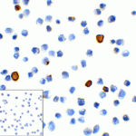 Immunocytochemistry of TIM-3 in transfected HEK293 cells with TIM-3 antibody at 1 μg/mL. Lower left: Immunocytochemistry in transfected HEK293 cells with control mouse IgG antibody at 1 μg/mL.