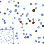 Immunocytochemistry of TIM-3 in transfected HEK293 cells with TIM-3 antibody at 1 μg/mL. Lower left: Immunocytochemistry in transfected HEK293 cells with control mouse IgG antibody at 1 μg/mL.