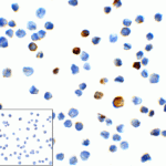Immunocytochemistry of TIM-3 in transfected HEK293 cells with TIM-3 antibody at 1 μg/mL. Lower left: Immunocytochemistry in transfected HEK293 cells with control mouse IgG antibody at 1 μg/mL.