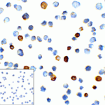 Immunocytochemistry of TIM-3 in transfected HEK293 cells with TIM-3 antibody at 1 μg/mL. Lower left: Immunocytochemistry in transfected HEK293 cells with control mouse IgG antibody at 1 μg/mL.