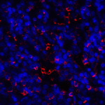 Immunofluorescence of TIM-3 in human spleen tissue with TIM-3 antibody at 20 μg/ml.<br><br>Red: TIM-3 Antibody (8659) <br> Blue: DAPI staining