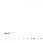 To detect hTIMP-1 by Western Blot analysis this antibody can be used at a concentration of 0.1 - 0.2 ug/ml. Used in conjunction with compatible secondary reagents the detection limit for recombinant hTIMP-1 is 1.5 - 3.0 ng/lane, under either reducing or non-reducing conditions.