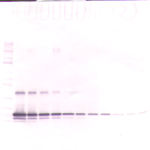 To detect hTIMP-1 by Western Blot analysis this antibody can be used at a concentration of 0.1 - 0.2 ug/ml. Used in conjunction with compatible secondary reagents the detection limit for recombinant hTIMP-1 is 1.5 - 3.0 ng/lane, under either reducing or non-reducing conditions.