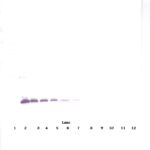 To detect hTIMP-1 by Western Blot analysis this antibody can be used at a concentration of 0.1 - 0.2 ug/ml. Used in conjunction with compatible secondary reagents the detection limit for recombinant hTIMP-1 is 1.5 - 3.0 ng/lane, under either reducing or non-reducing conditions.