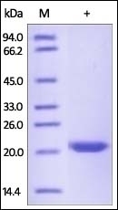 TIMP-2 Recombinant Protein