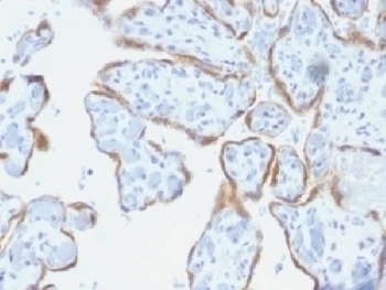 TIMP2 Antibody [SPM356]