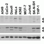 <strong>Figure 2 Independent Antibody Validation (IAV) via Protein Expression Profile in Human Cell Lines</strong><br>Loading: 15 µg of lysates per lane.Antibodies: TIP47 3881 (4 μg/mL), TIP47 3883 (1 μg/mL), and beta-actin (1 μg/mL), 1h incubation at RT  in 5% NFDM/TBST.Secondary: Goat anti-rabbit IgG HRP conjugate at 1:10000 dilution.