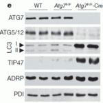 <strong>Figure 6  Induced Expression Validation of TIP47 in Atg7 Liver KO Mice  (Singh et al., 2009) </strong><br>TIP47 expression detected by anti-TIP47 antibodies was markedly increased in the liver of Atg7 liver KO mice.