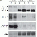 <strong>Figure 7  Induced Expression Validation of TIP47 in Mouse Liver (Singh et al., 2009) </strong><br>TIP47 expression detected by anti-TIP47 antibodies was increased  in the autophagic vacuoles (AVs) and lysosomes (Lys) after starvation.